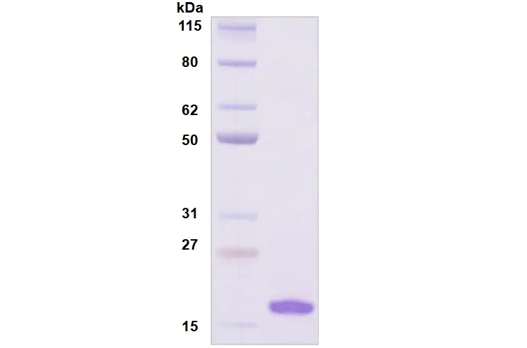[MC09-025] Recombinant Human Siglec-7, His Tag -25 ug